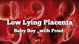 Low Lying Placenta💖Placenta position really predict the Baby Gender💖Baby Boy scan reports proof [upl. by Sualohcin]