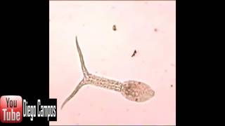 Schistosoma mansoni  Cercaria [upl. by Zoller]