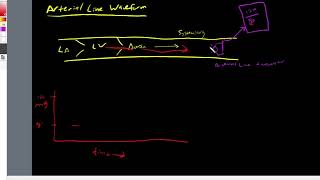 The Arterial Line Waveform EXPLAINED [upl. by Ailsa]