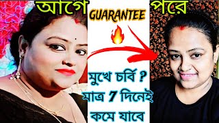 মুখে চর্বি  এই সহজ এক্সারসাইজ করে 7 দিনে কমিয়ে ফেলুন  Lose Double Chin amp Face Fat In 10 Days [upl. by Iblok]