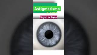 Astigmatismo según la Regla [upl. by Rame]