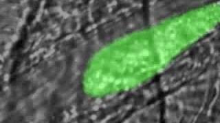 Real time thrombus formation after a laserinduced injury [upl. by Mya242]