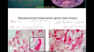 Microbiology practical Mycobacterium [upl. by Brynn515]