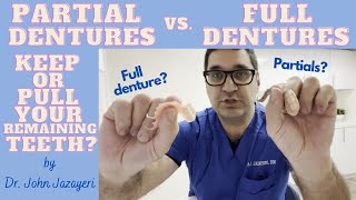 Partials vs Full Dentures Should You Keep or Remove Your Remaining Teeth [upl. by Sheya412]