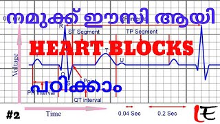 Basics of ECG episode2 AV blocks heart blocks 123 degree blocks in Malayalam [upl. by Zeta]