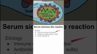 Serum sicknesslike reaction [upl. by Oiralednac]