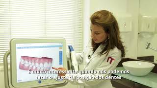 Conheça o iTero  Scanner Invisalign [upl. by Artus970]