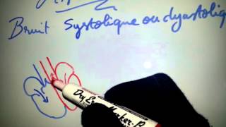 Astuce  bruit systolique ou diastolique   Dr Astuce [upl. by Lovich11]