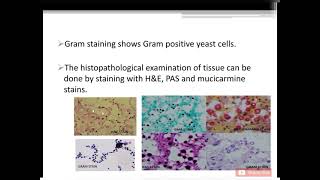 Mycology Cryptococcosis Cryptococcus neoformans [upl. by Enayd]