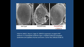 Surgery in the Care of Medullary Thyroid Cancer [upl. by Sink631]