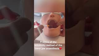 practice anaesthesia of lower jawclinic story today shorts [upl. by Norvall146]