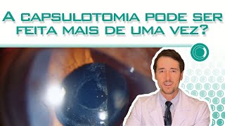 O YAG laser pode ser repetido [upl. by Stefan]