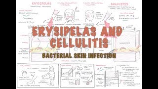 Bacterial Skin Infection  Cellulitis and Erysipelas Clinical Presentation Pathology Treatment [upl. by Orin738]