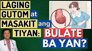 Laging Gutom at Masakit ang Tiyan Bulate Ba Yan  By Doc Willie Ong Internist and Cardiologist [upl. by Eehc148]