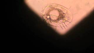 Rotifers and other micro species from a fish tank filter under microscopem2t [upl. by Nifled]