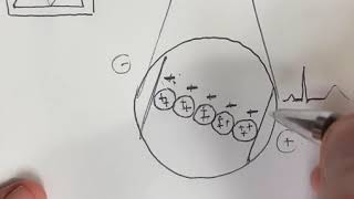 Why the Twave is normally concordant with QRS Part 1 [upl. by Melamed]