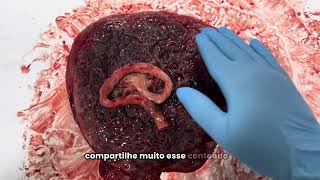 😱PLACENTA E O CORDÃO UMBILICAL  Órgão incrível da formação da vida [upl. by Dari]