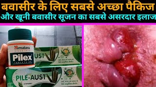 Pile Aust Ointment  Pilex Tablets use or Benefits in Hindi  बवासीर का पूरा असरदार इलाज [upl. by Intosh]