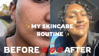 ✨KOREAN SKINCARE PRODUCTS THAT GAVE ME GLOWY  GLOSSY SKIN  HELPED MY HYPERPIGMENTATION amp ECZEMA✨ [upl. by Lemcke]