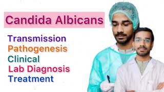 Candida Albicans  Transmission  Pathogenesis  Clinical  Lab Diagnosis  Treatment [upl. by Coralie]