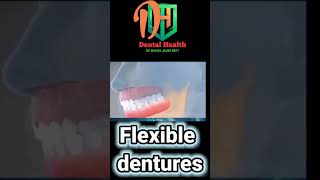 Flexible dentures short viral  tiktok challenge tiktok dental [upl. by Anirahc362]