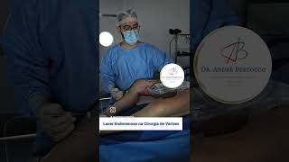 Laser Endovenoso na Cirurgia de Varizes varizes saude laser veias vasinhos skincare estetica [upl. by Haerdna522]