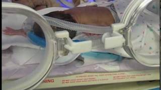 Preemies What to Expect [upl. by Akla]