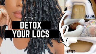 HOW TO DETOX YOUR LOCS [upl. by Anelagna]