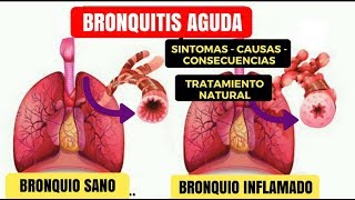 Bronquitis  Como Curar La Bronquitis  Remedios Caseros Para Tratar La Bronquitis tos [upl. by Pulcheria]