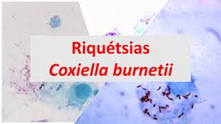 Microbiologia Médica Riquétsias e Coxiella burnetti [upl. by Ilocin731]