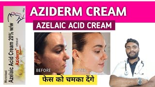 Azelaic acid cream  How to use azelaic acid cream  Best azelaic acid cream  Aziderm cream [upl. by Broddie438]