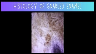 Histology of Gnarled Enamel  Dentistry [upl. by Nye]