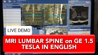 Lumbar Spine MRI scan protocol positioning and planning on GE 15 Tesla  Live Demo in English [upl. by Dennis]