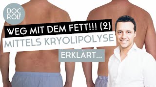 KRYOLIPOLYSE BEHANDLUNG – Fett weg Teil 2 mit Dr Rolf Bartsch [upl. by Atikaj125]