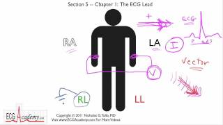 Basics of ECG Leads 51  ECG  EKG Interpretation  BASIC [upl. by Riocard]