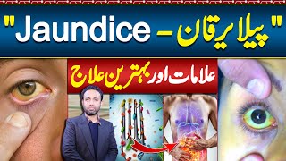 Jaundice Symptoms and Treatment  Jaundice Foods To Eat and Avoid  Pela Yarkan Ka ilaj [upl. by Kimitri425]