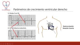 Crecimiento ventricular derecho [upl. by Grieve]