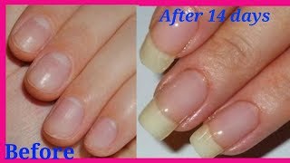 Diy Nail growth serum nail grow recepie  how to grow nails [upl. by Tymon]