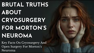 Here are some direct straightforward facts about cryosurgery for Mortons Neuroma [upl. by Ika462]