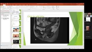 oct 2024 pleural effusion  accreta extramniotic pregnancy  andominal pregnancy best of isuog [upl. by Kattie]