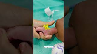 Bandeya 💉🌡️✌️ ivcannulation newbornbaby babydocter ytshorts kidsvideo injection viralvideo [upl. by Kinna]