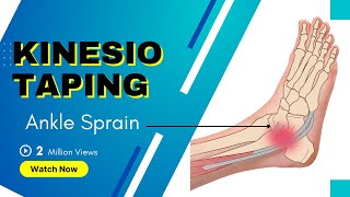 How to treat an Ankle Inversion Sprain  Kinesiology Taping to stabilise ligaments [upl. by Eldridge865]