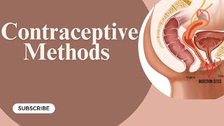 Contraceptive methods  Gynaecology Lecture  Part 11 [upl. by Ashraf]