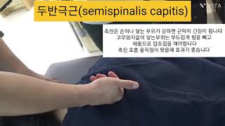 두반극근  semispinalis capitis  촉진및 도수운동 ㅡ뒷목과 등이 뻐근하다면 이 근육일수도 있습니다 목틍증 등통증 [upl. by Ycnan]