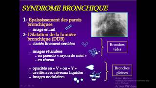 syndrome bronchique partie 03 DDB [upl. by Parsifal]