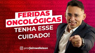 FERIDAS ONCOLÓGICAS TENHA ESSE CUIDADO [upl. by Byron]