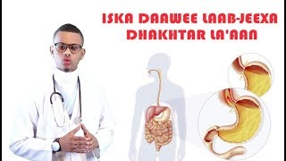 ISKA DAAWEE XANUUNKA LAAB JEEXA DHAKHTAR LAAAN Dr faris [upl. by Annabal]