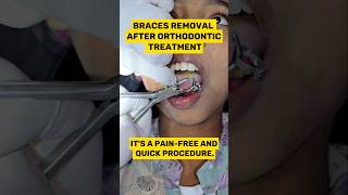 PAIN LASS BRACES REMOVAL AFTER ORTHODONTIC TREATMENT dentist shorts trending [upl. by Aliuqa483]