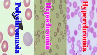 Hypochromia Hypochromia and polychromasia Blood Smear Examination blood smear Lecture 3 [upl. by Anehs]