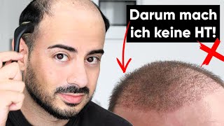 Reue nach der Haartransplantation  Er hat einen Fehler gemacht [upl. by Rammus190]